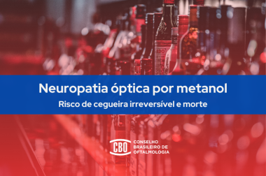 Oftalmologistas alertam para a neuropatia óptica, o risco de cegueira pela ingestão de álcool contaminado com metanol Oftalmologistas alertam para a neuropatia óptica, o risco de cegueira pela ingestão de álcool contaminado com metanol