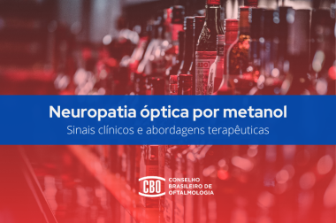 Neuropatia óptica tóxica por metanol: abordagem diagnóstica e terapêutica em casos suspeitos Neuropatia óptica tóxica por metanol: abordagem diagnóstica e terapêutica em casos suspeitos