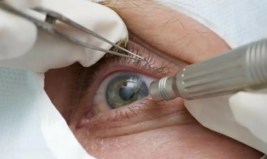 Alerta à População: CBO adverte sobre ceratopigmentação de caráter exclusivamente estético